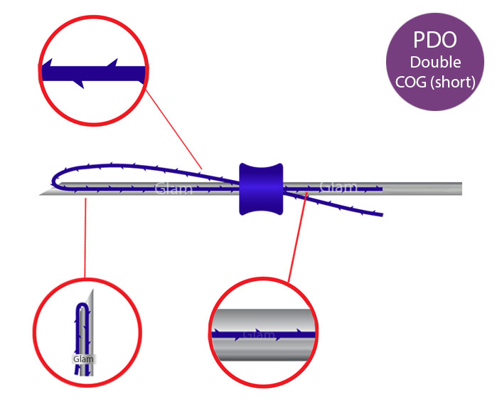Glam Lifting Thread PDO Double Cog 23g 90mm 150mm